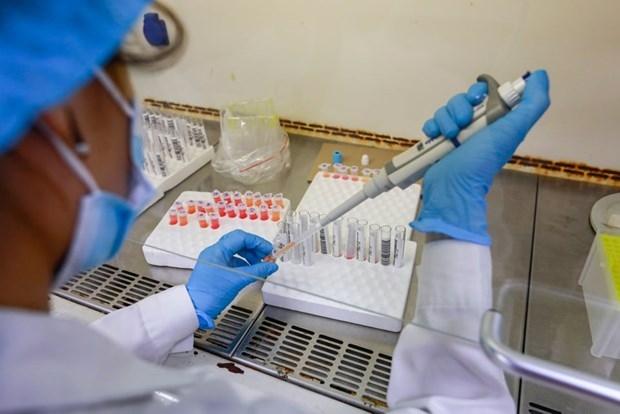 Bộ Y tế thông tin về hình thức đấu thầu hóa chất, đặt máy, mượn máy Bộ Y tế thông tin về hình thức đấu thầu hóa chất, đặt máy, mượn máy