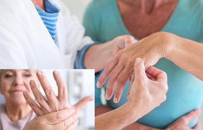 Nguyên nhân viêm khớp dạng thấp dễ trở nặng vào mùa đông