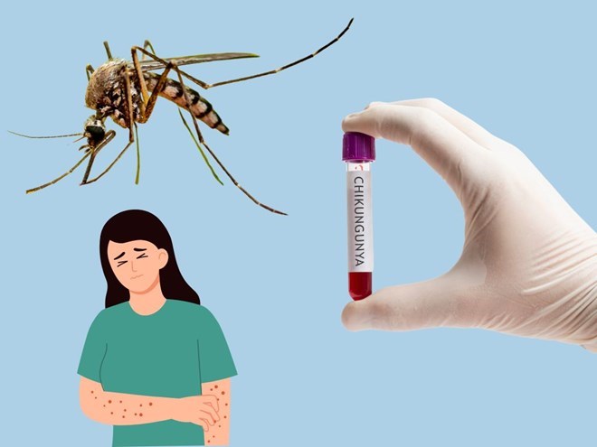 Bộ Y tế bác tin Việt Nam ghi nhận ca mắc bệnh Chikungunya
