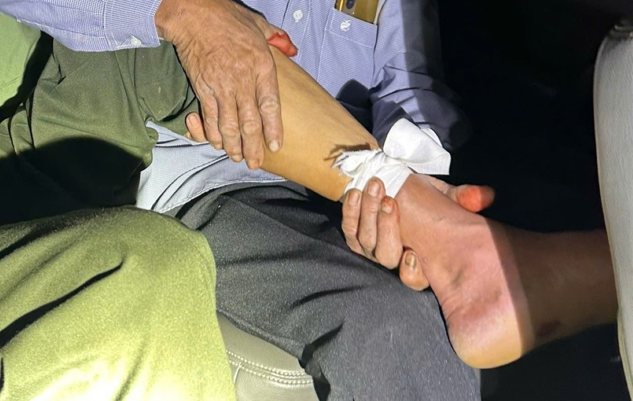 Người dân sơ cứu vết thương do rắn độc cắn vào chân trước khi CSGT chở đi cấp cứu. Ảnh: CSGT