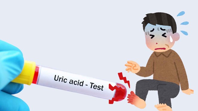 3 thói quen vào buổi sáng khiến axit uric tăng vọt