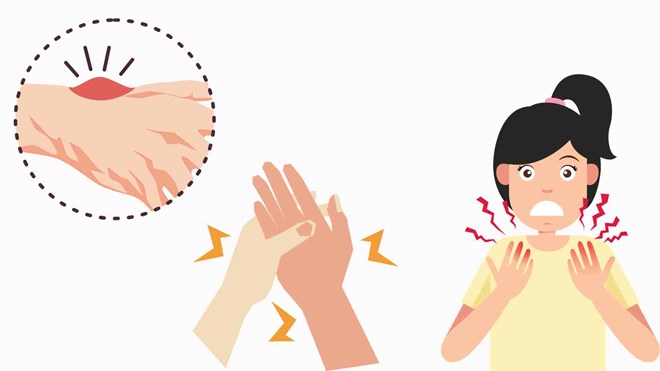 5 bất thường ở bàn tay báo hiệu suy thận